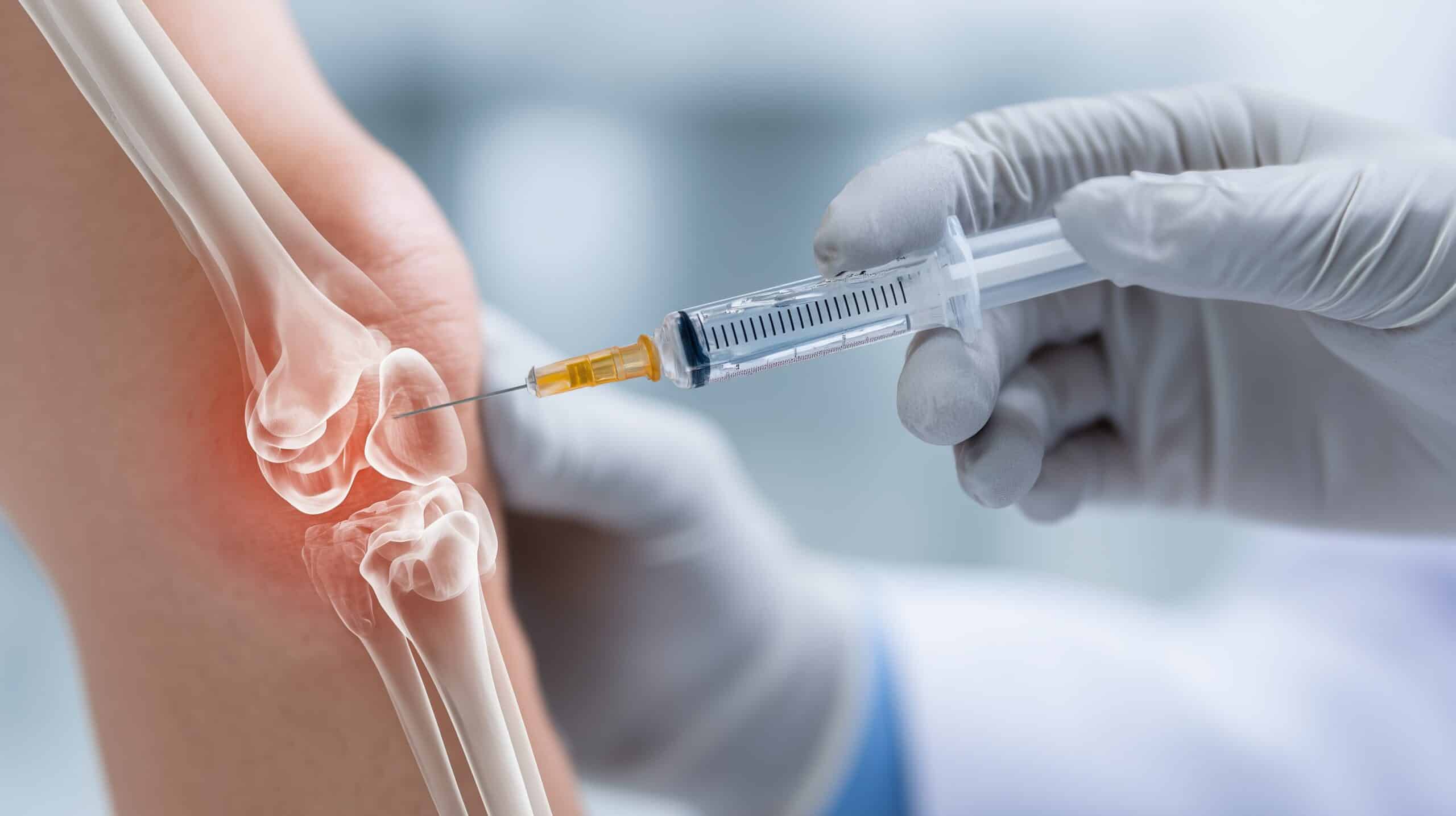 Gloved hand giving an injection into the knee, with the joint highlighted Gloved hand giving an injection into the knee, with the joint highlighted
